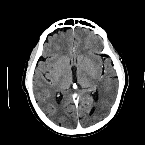 Brain CT slice rendered in ZenView